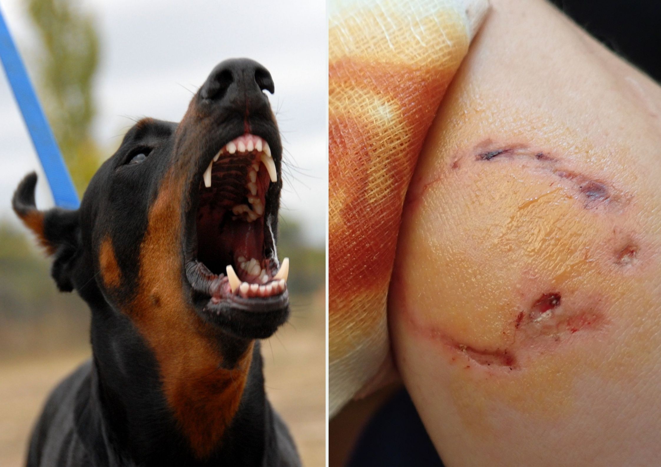 ugryzienie przez psa